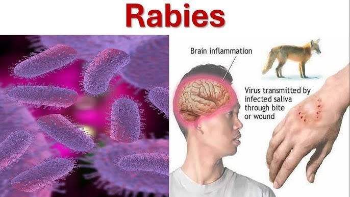 EXPLORING RABIES TRANSMISSION: PATTERNS AND PREVENTION STRATEGIES