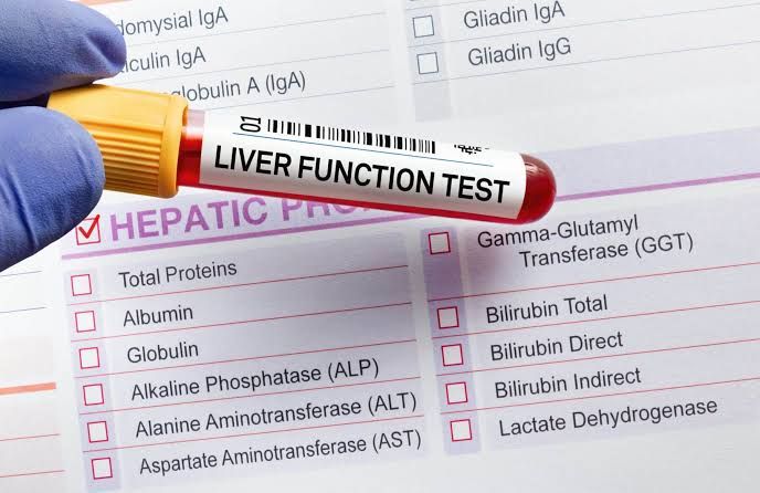TYPES OF ORGAN FUNCTION TESTS YOU SHOULD KNOW