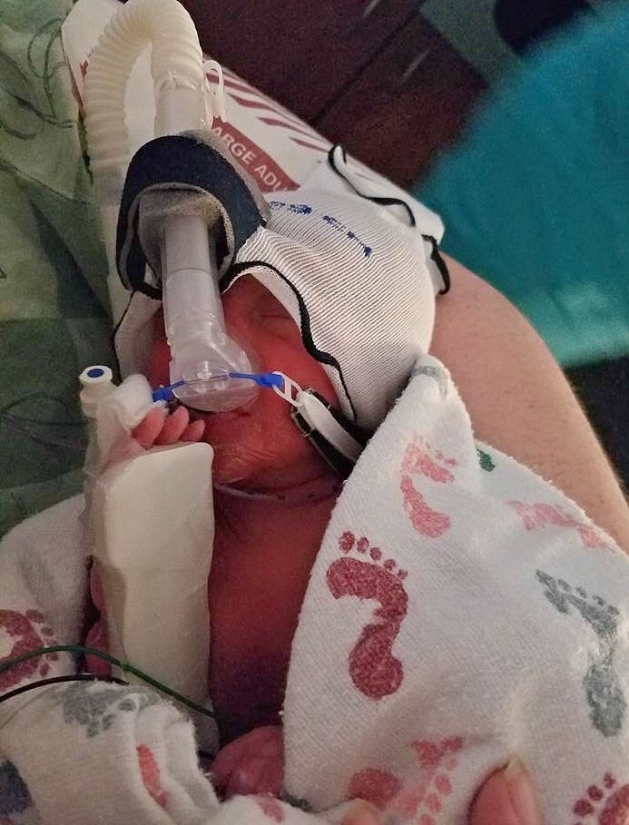 Vinnie King was born weighing four pounds and one once. Photo submitted by Danielle King.