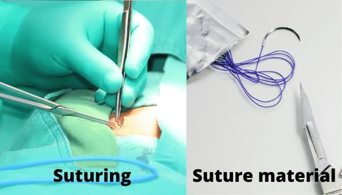 DRESSING SUTURE AND INSTRUMENTS DRESSING SUTURE AND INSTRUMENTS