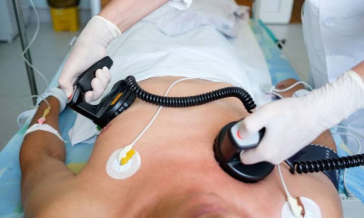 DURING GENERAL ANESTHESIA, A PATIENT DEVELOPS ATRIAL FIBRILLATION WITH RAPID VENTRICULAR RESPONSE AND HYPOTENSION DURING GENERAL ANESTHESIA, A PATIENT DEVELOPS ATRIAL FIBRILLATION WITH RAPID VENTRICULAR RESPONSE AND HYPOTENSION