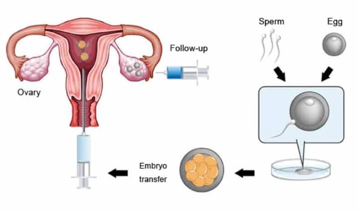 EMBRYO TRANSFER TECHNOLOGY EMBRYO TRANSFER TECHNOLOGY