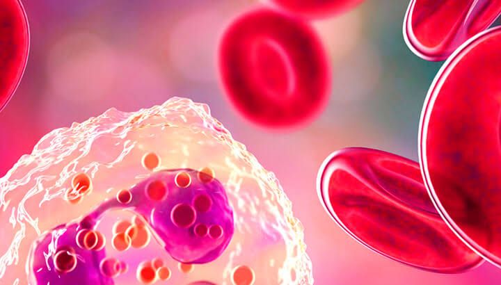 MYELODYSPLASTIC SYNDROME TREATMENT OPTIONS: WHAT YOU NEED TO KNOW