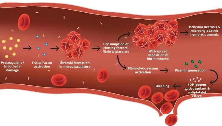 DISSEMINATED INTRAVASCULAR COAGULATION AND THROMBOTIC THROMBOCYTOPENIC PURPURA