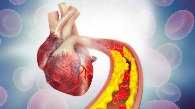 A CLOSER LOOK AT THE PHARMACOLOGICAL AGENTS TARGETING DYSLIPIDEMIAS