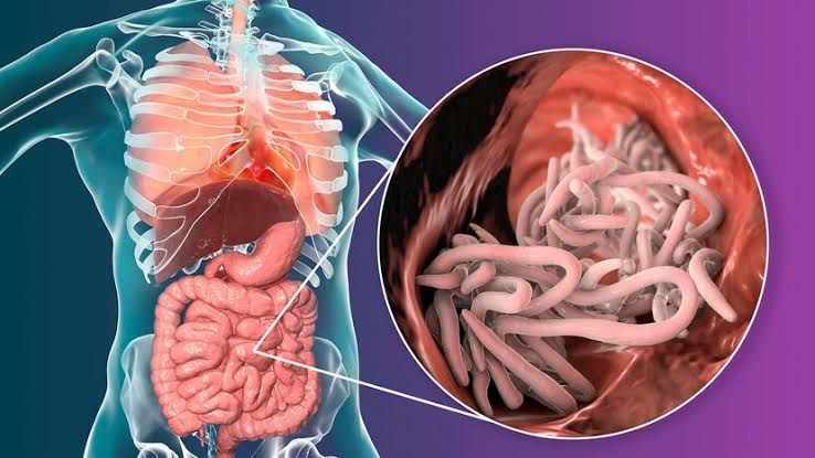 HELMINTH INFECTIONS: CAUSES, SYMPTOMS, AND TREATMENT