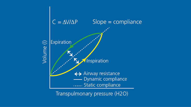 PULMONARY VENTILATION: KEY FACTS YOU SHOULD KNOW PULMONARY VENTILATION: KEY FACTS YOU SHOULD KNOW