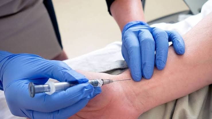 THE BASICS OF ARTERIAL BLOOD GAS INTERPRETATION THE BASICS OF ARTERIAL BLOOD GAS INTERPRETATION