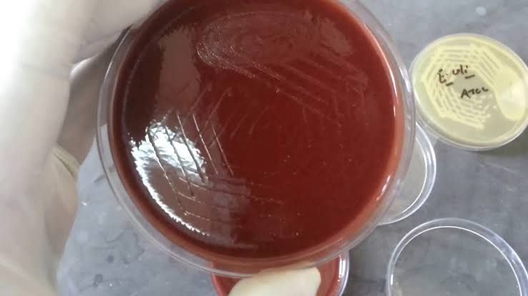 STEPS TO TAKE BEFORE GETTING A URETHRAL DISCHARGE CULTURE