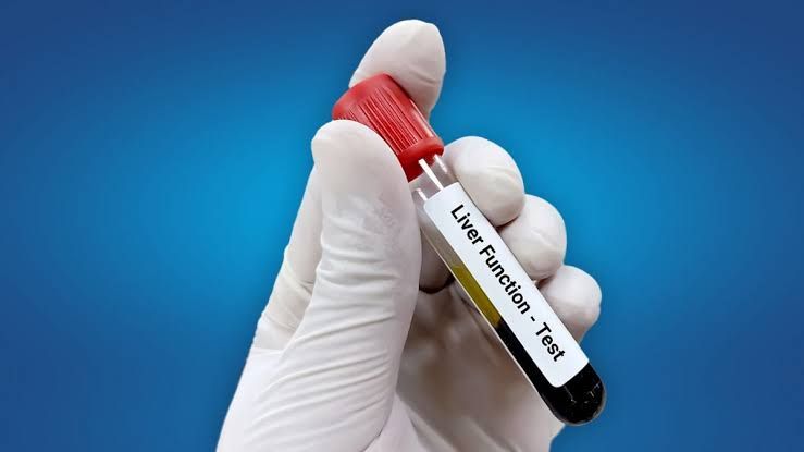 LIVER FUNCTION TESTS EXPLAINED IN SIMPLE TERMS LIVER FUNCTION TESTS EXPLAINED IN SIMPLE TERMS