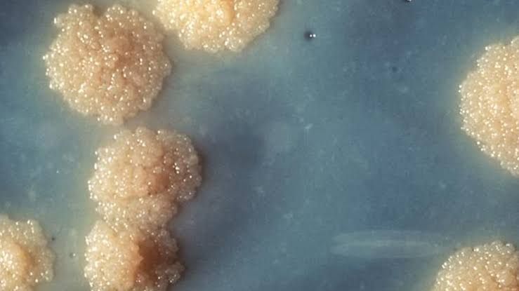 WHAT IS MYCOBACTERIUM TUBERCULOSIS: A COMPREHENSIVE OVERVIEW WHAT IS MYCOBACTERIUM TUBERCULOSIS: A COMPREHENSIVE OVERVIEW