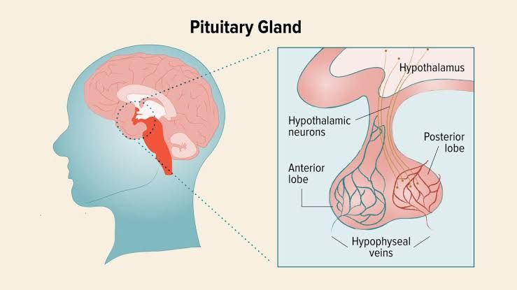COMMON DISEASES OF THE ANTERIOR PITUITARY GLAND COMMON DISEASES OF THE ANTERIOR PITUITARY GLAND