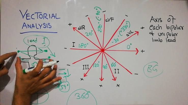 VECTORIAL ANALYSIS OF ECG VECTORIAL ANALYSIS OF ECG