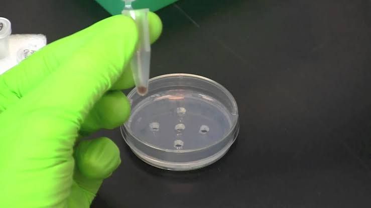 DOUBLE IMMUNODIFFUSION TEST USING SPECIFIC ANTIBODY AND ANTIGEN