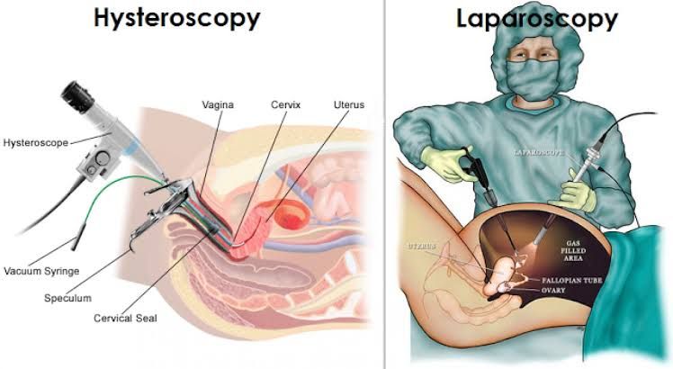 PREPARING FOR SURGERY: WHAT YOU NEED TO KNOW ABOUT GYNAECOLOGICAL PROCEDURES PREPARING FOR SURGERY: WHAT YOU NEED TO KNOW ABOUT GYNAECOLOGICAL PROCEDURES