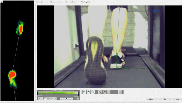 high speed gait analysis