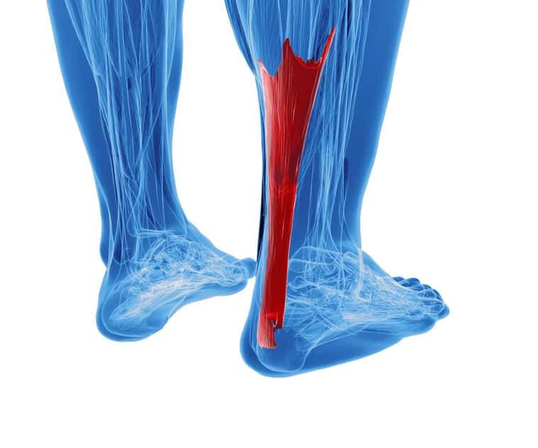 An illustration showing the anatomy of the Achilles tendon. The tendon is highlighted in red and the rest of the anatomy is blue.