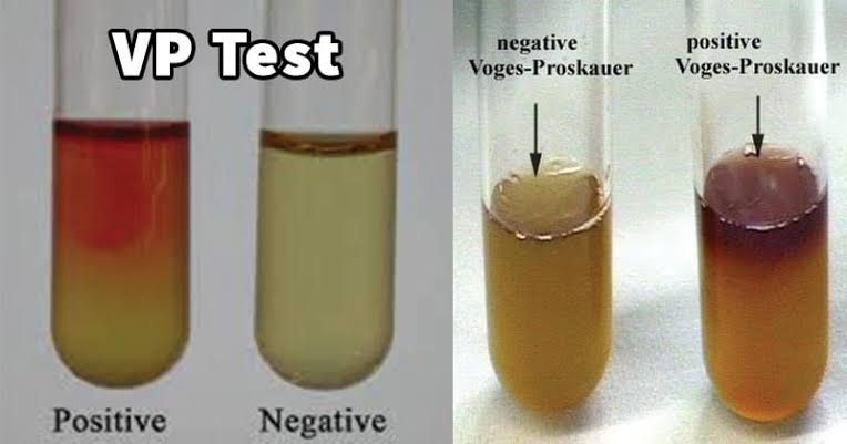 BIOCHEMICAL TESTS FOR IDENTIFICATION OF BACTERIA