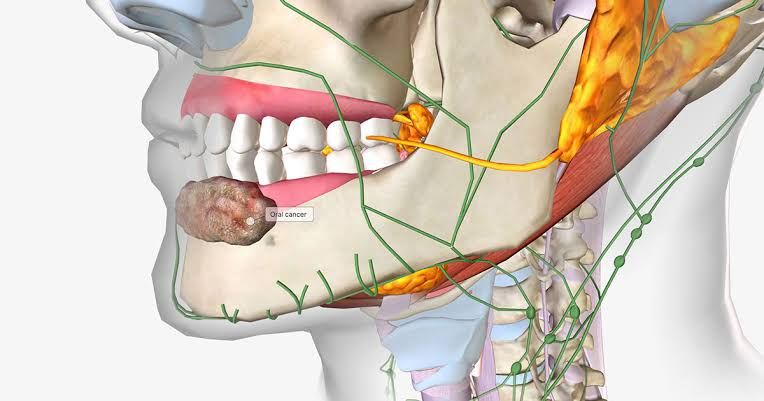 NEOPLASTIC CONDITIONS OF THE ORAL CAVITY: EXPERT ANALYSIS AND RECOMMENDATIONS