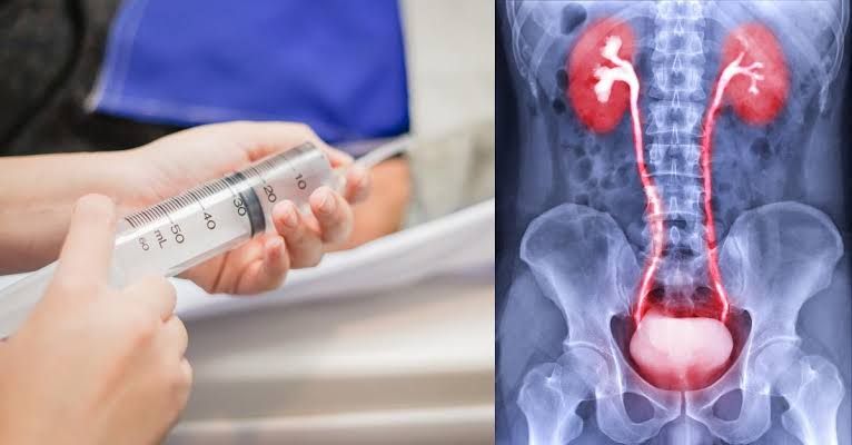 BENEFITS OF CONTRAST MEDIA IN DIAGNOSING DISEASES