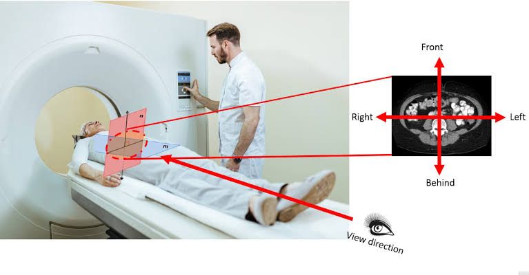 THORACIC INLET: RELATIONS AND CROSS-SECTIONAL ANATOMY