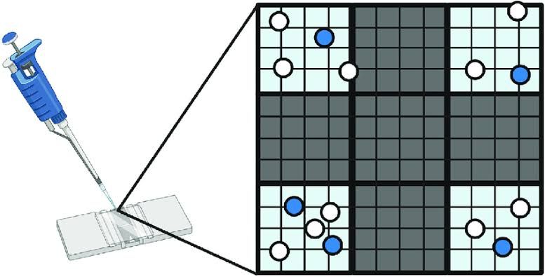 OVERVIEW OF CELL COUNTING WITH A HEMOCYTOMETER OVERVIEW OF CELL COUNTING WITH A HEMOCYTOMETER