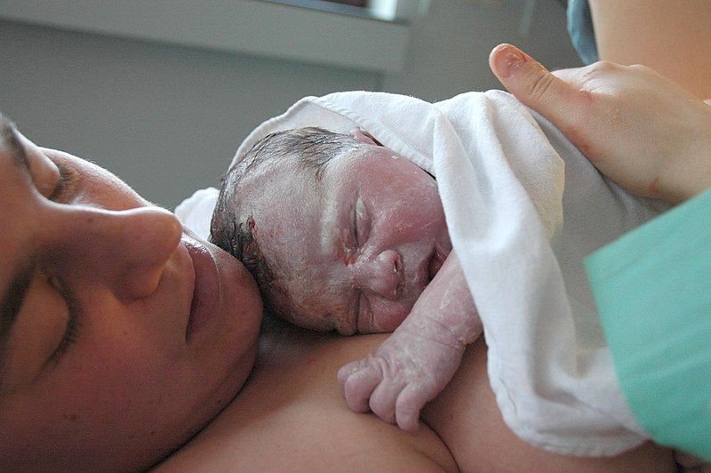 OTHER COMPLICATIONS OF THE THIRD STAGE OF LABOR OTHER COMPLICATIONS OF THE THIRD STAGE OF LABOR
