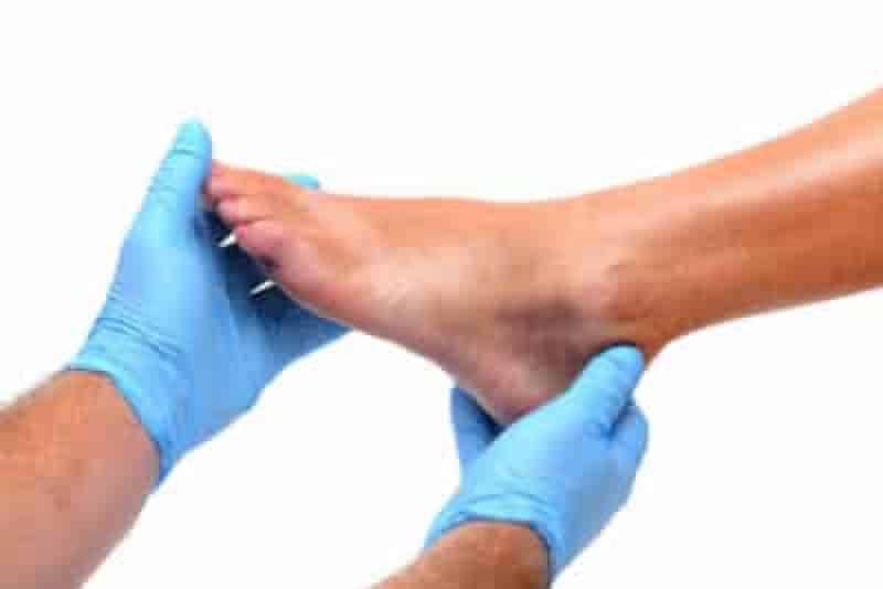 A podiatrist with blue gloves is holding a patient's foot for assessment